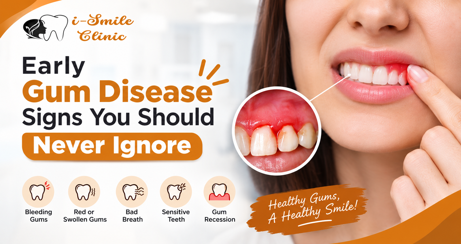 Early Signs of Gum Disease You Should Never Ignore